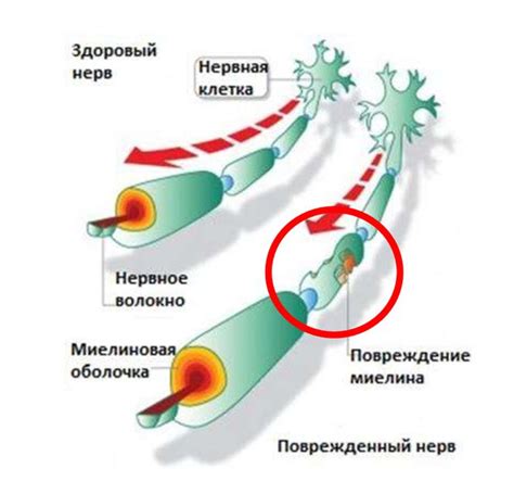 Понимаем процесс заболевания